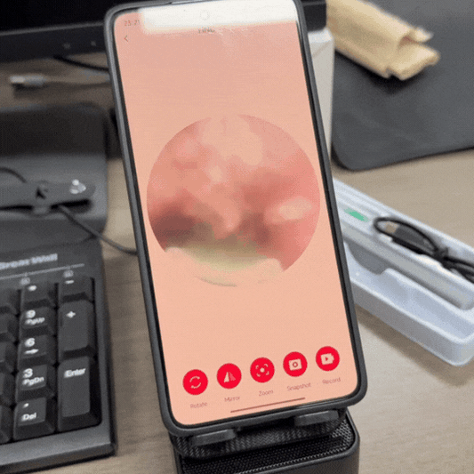Kit de Îndepărtare Ceară de Urechi fără Fir cu 7 Piese, Cameră și Lumină, 6 Vârfuri, pentru iOS și Android – Ofertele Zilei