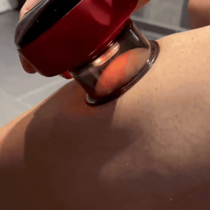 Aparat Electric cu Ventuze pentru Masaj